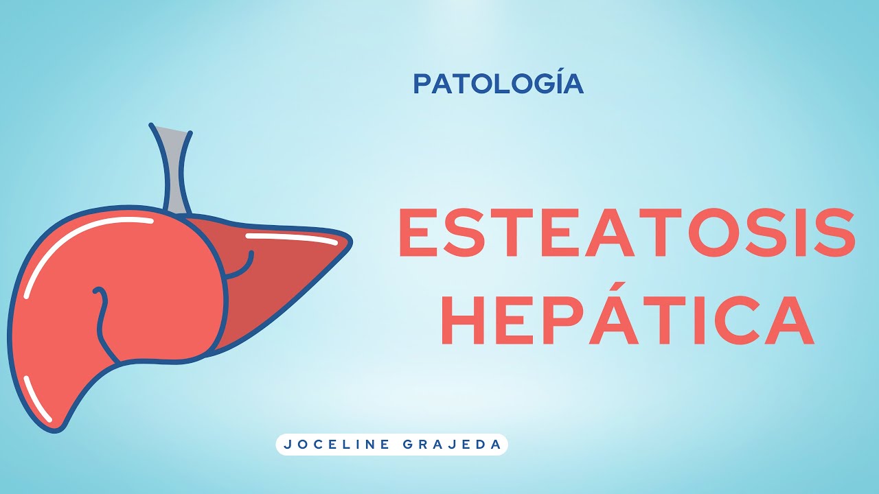 Esteatosis Hepática | Patología