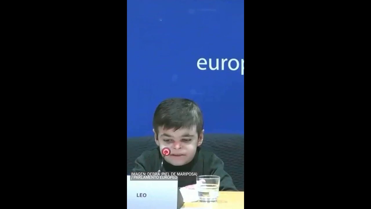 LEO, el peque&ntilde;o con piel de MARIPOSA que ha contado su d&iacute;a a d&iacute;a en el Parlamento EUROPEO #shorts