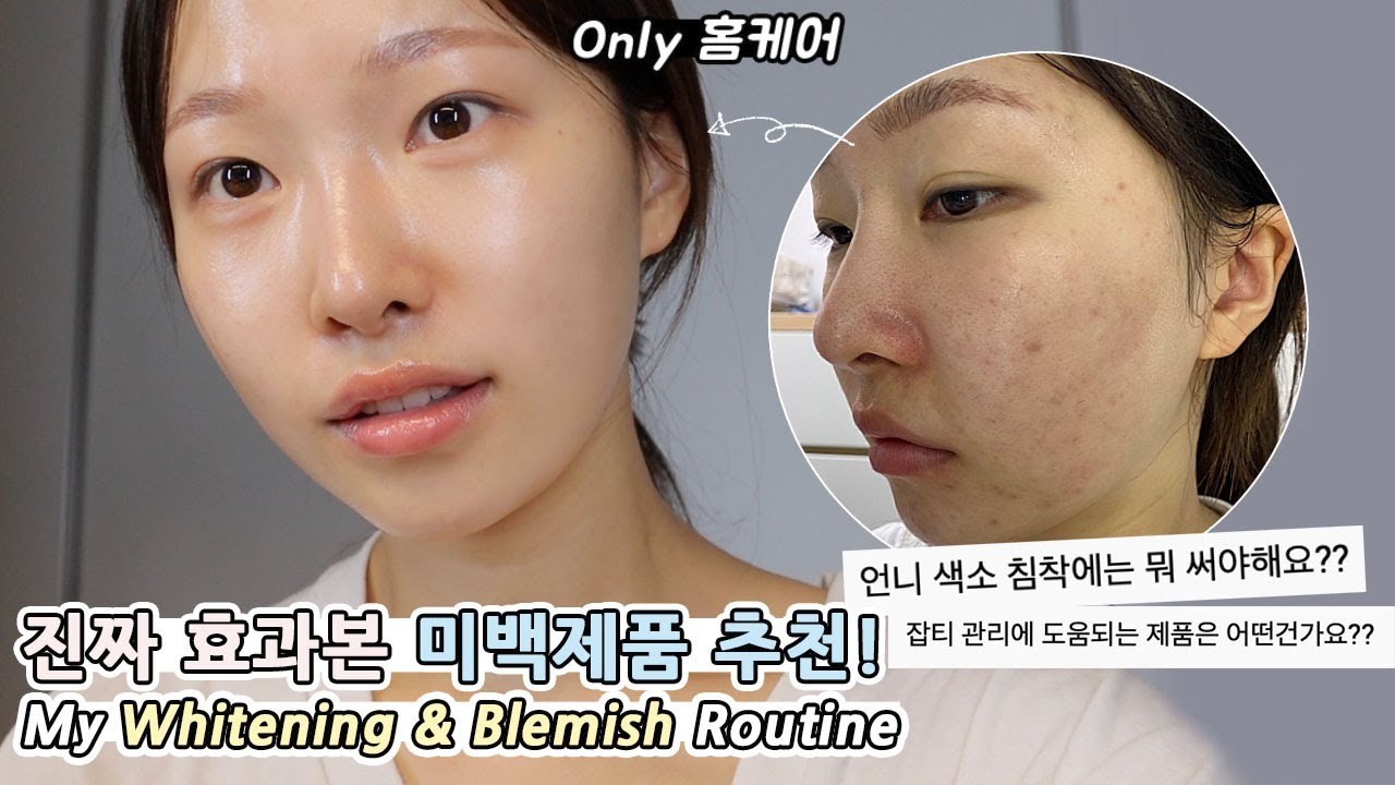 cc) 피부가하얘진 꿀템✨색소침착/트러블자국 효과!ㅣBlemish Routineㅣ아랑