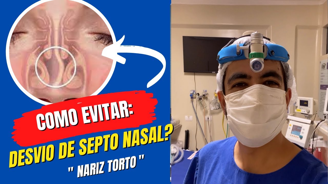 Como evitar o desvio de septo nasal, nariz torto e quebrado