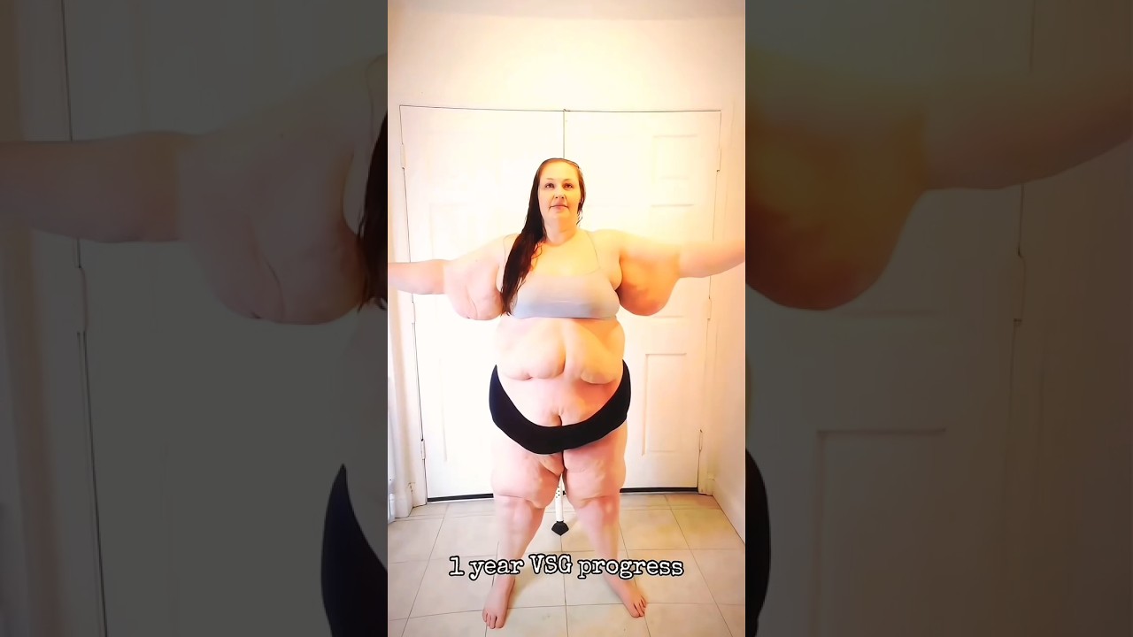 AMAZING WEIGHT LOSS TRANSFORMATION😳