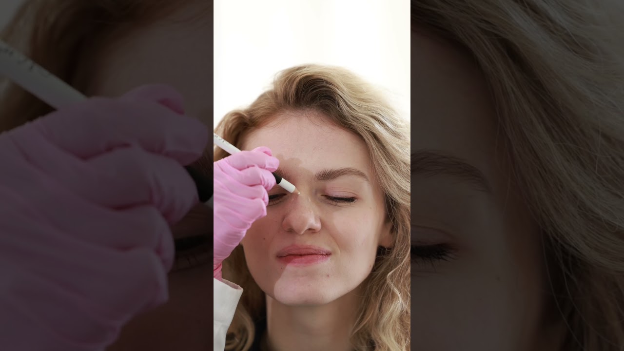 What is Nose-Tox? The cheat code for the perfect nose. #nosejobs #aesthetics #botox #medispa #filler