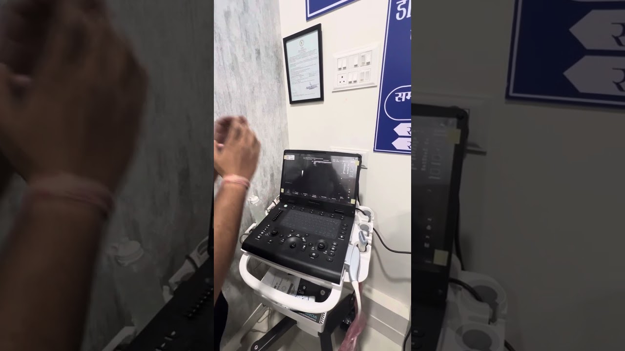 Ge versana active demo part 2 | Ultrasound Doppler | 