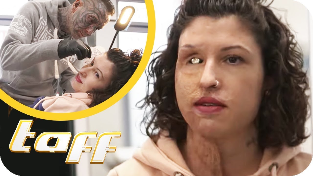 Nach S&auml;ure-Angriff: Gesichts-Tattoo f&uuml;r Vanessa! | taff | ProSieben