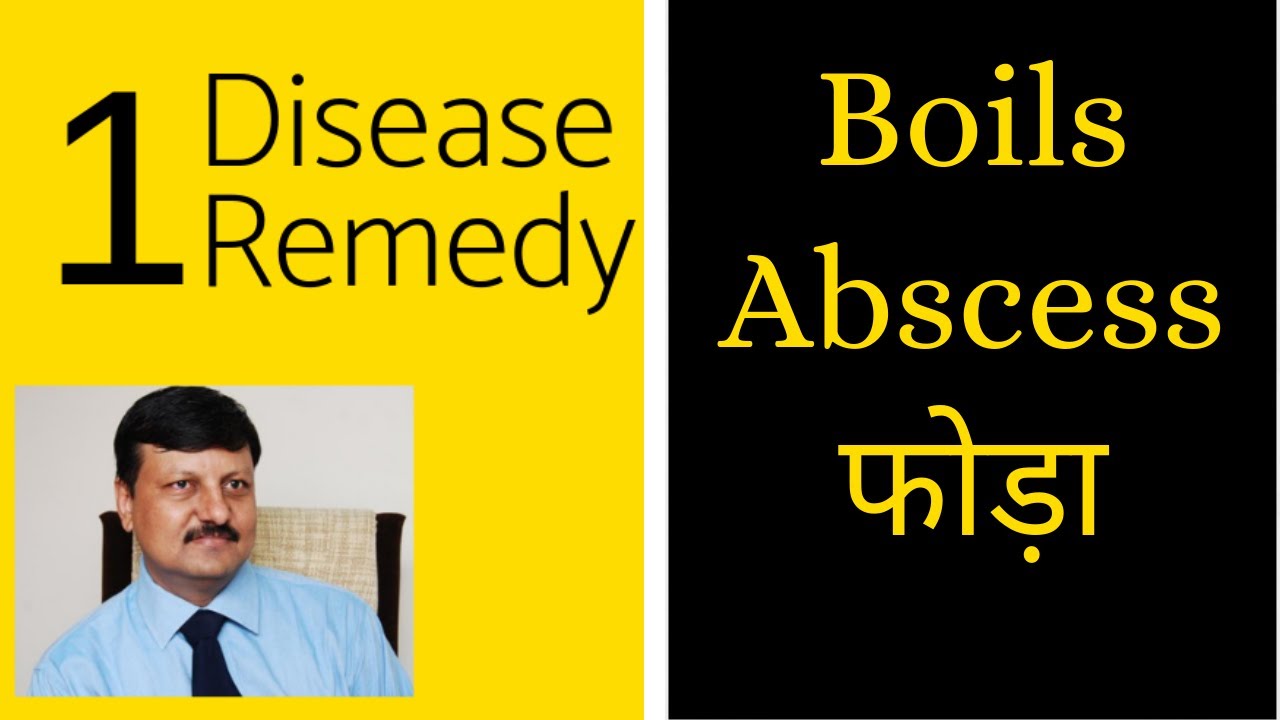 Boils | #4 | One Disease One Remedy | Dr. Ketan Shah - M.D. Homeopath |