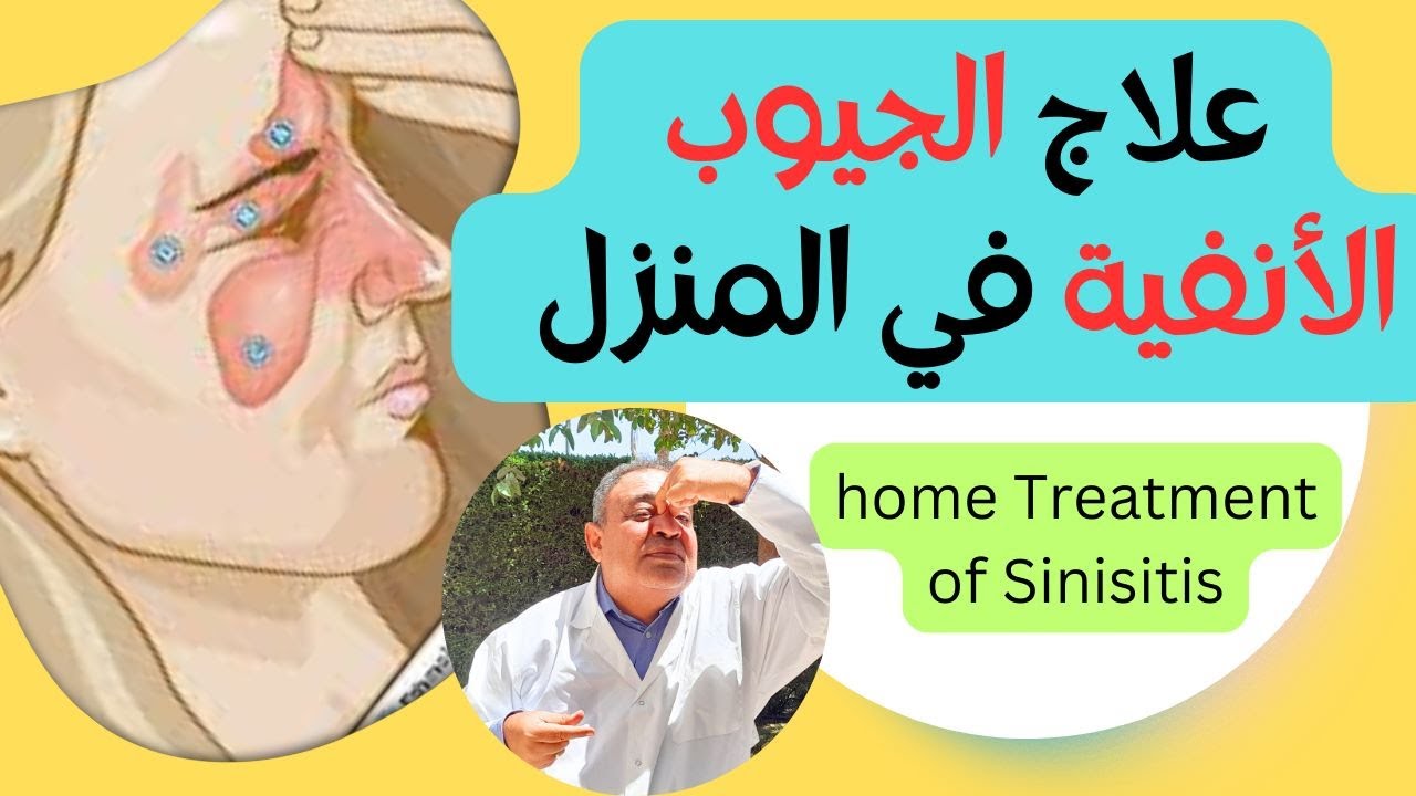 إلتهاب الجيوب الانفية |  حل مشكلة الجيوب الانفية نهائيا