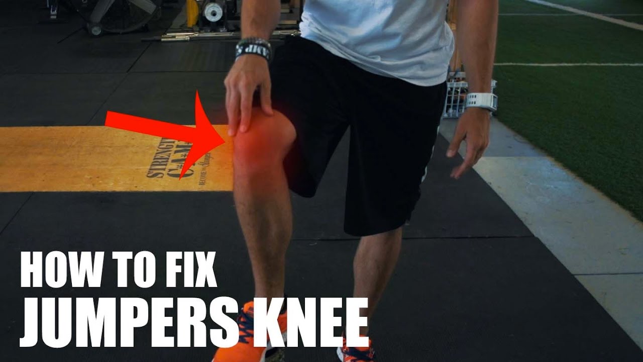 The Only Jumpers Knee Video You Need To Watch | Overtime Athletes
