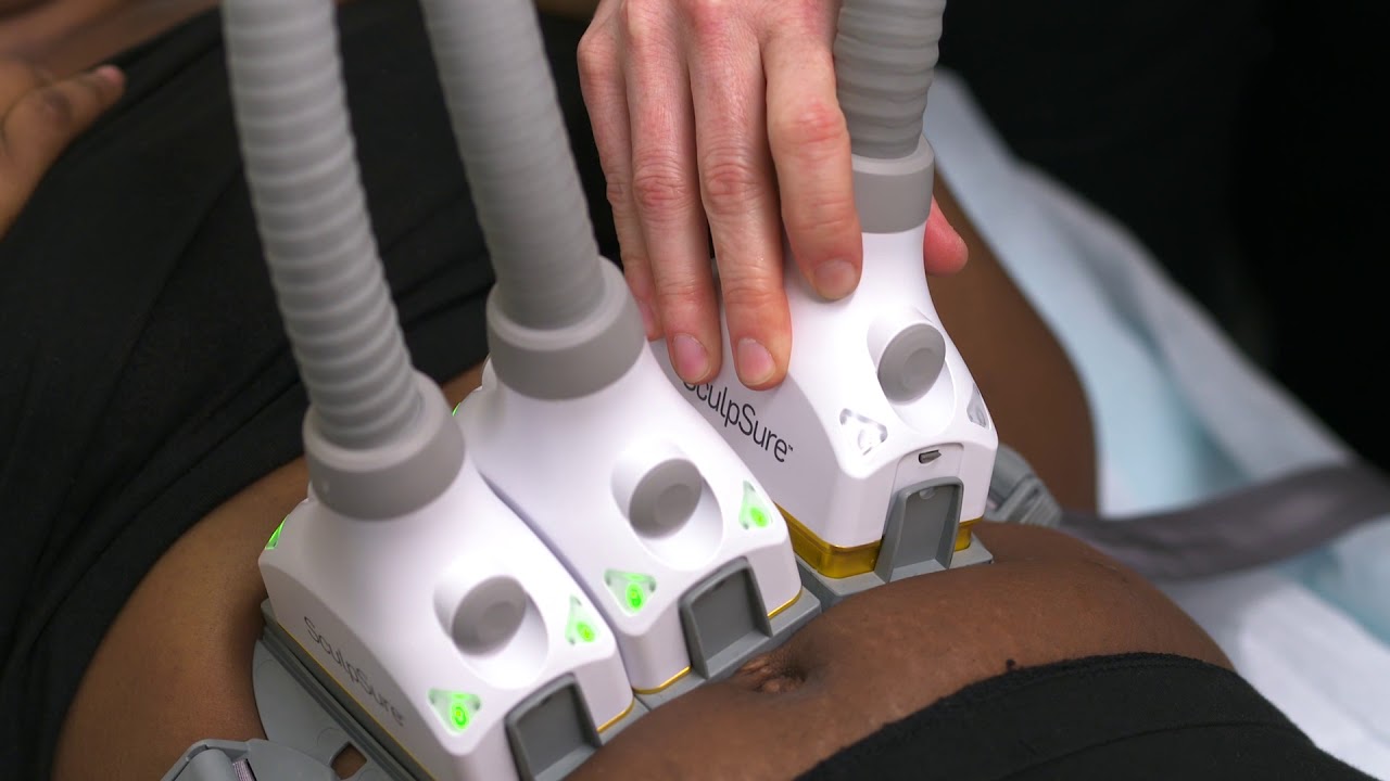 SculpSure Treatment (What to Expect)