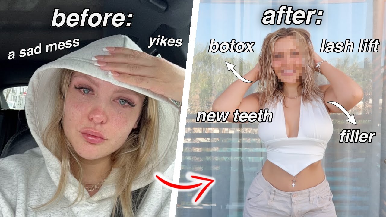 Spending £2000 to glow up after heartbreak *EXTREME TRANSFORMATION*