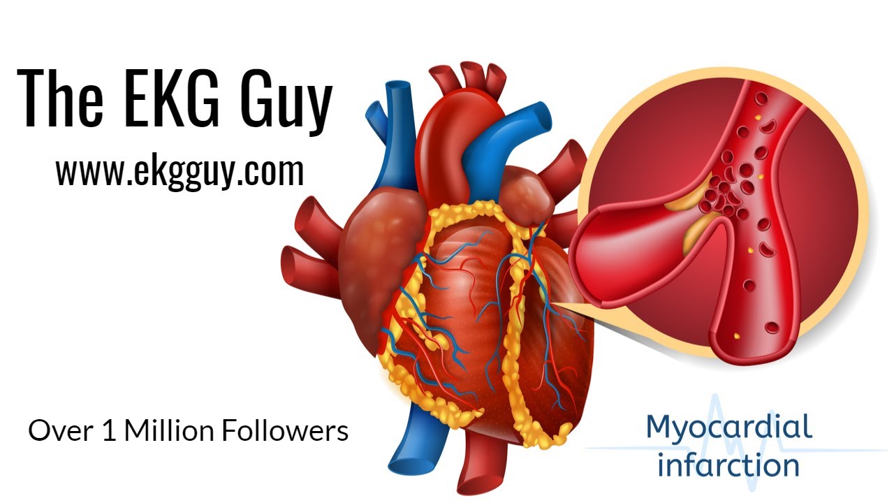 The EKG Guy | EKG Analysis Breakdown