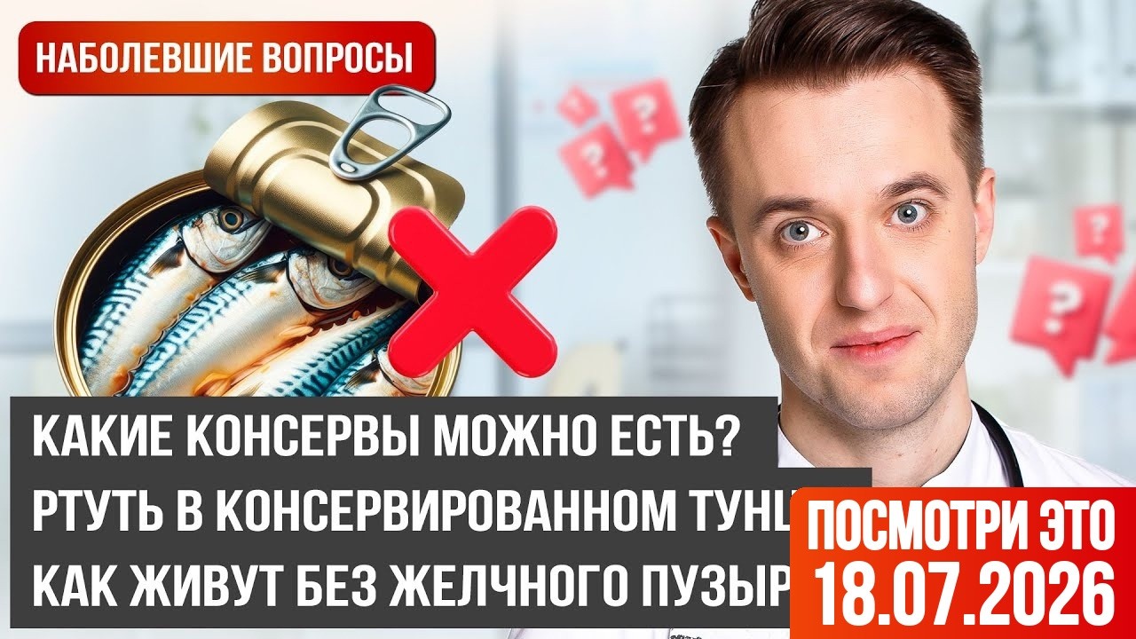 Ответы про ЖКТ от гастроэнтеролога: консервы, хеликобактер, рефлюкс