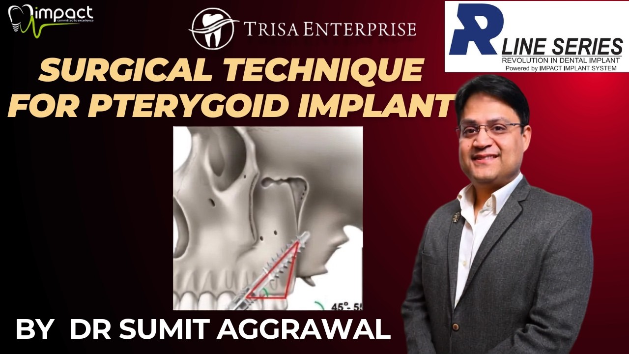 SURGICAL TECHNIQUE FOR PTERYGOID IMPLANT  - BY  DR SUMIT AGGRAWAL ( part 1 )
