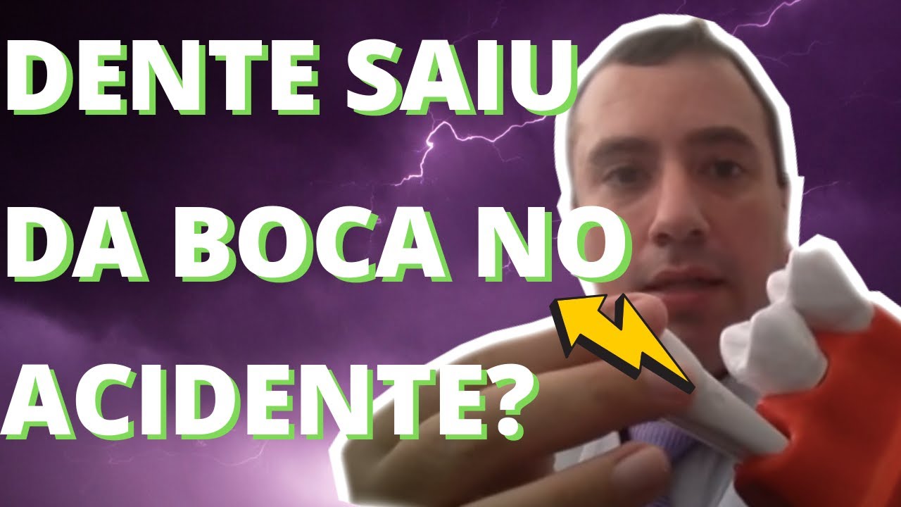 Dente permanente caiu (o que fazer) - dente avulsionado