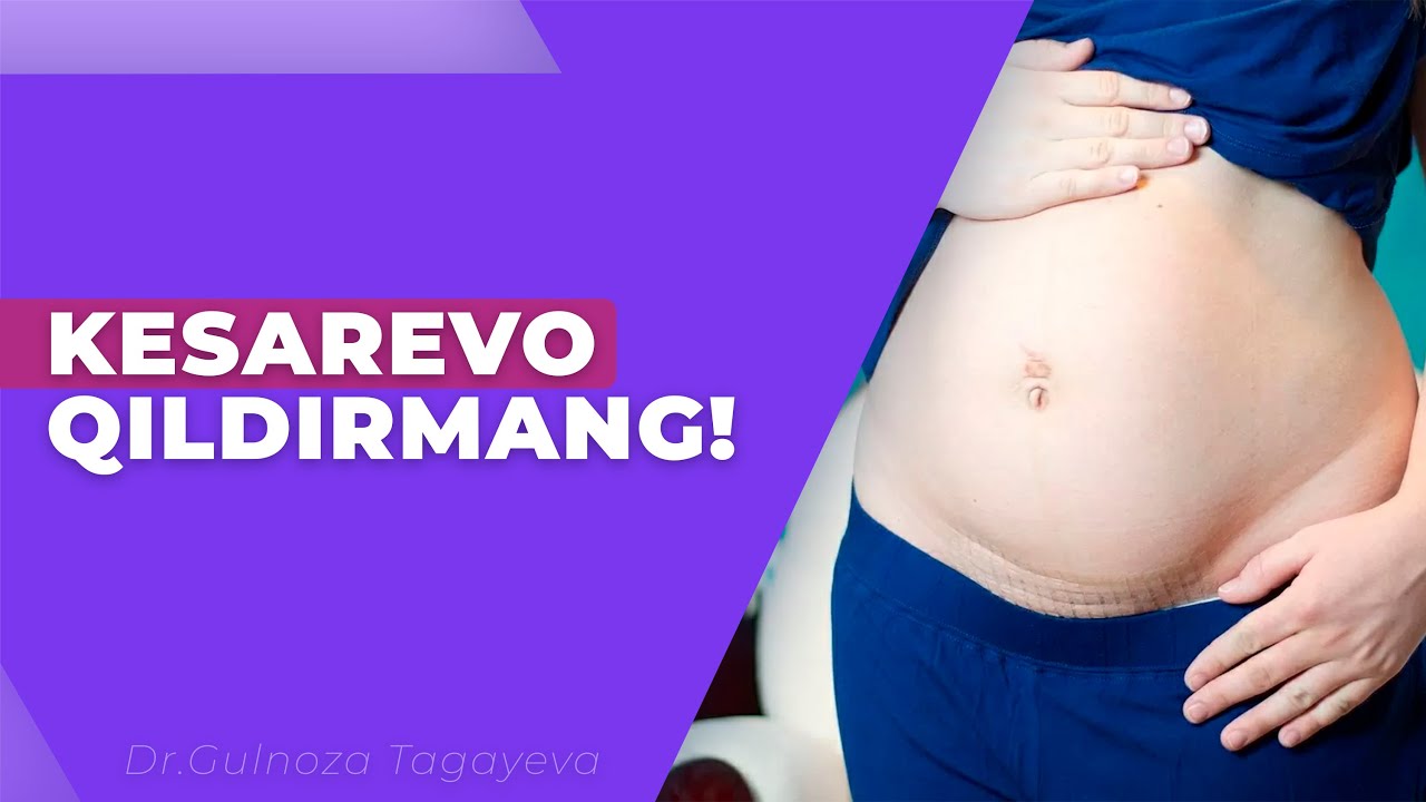Onalar bilishi kerak: kesarevо qachon kerak, qachon mumkin emas?