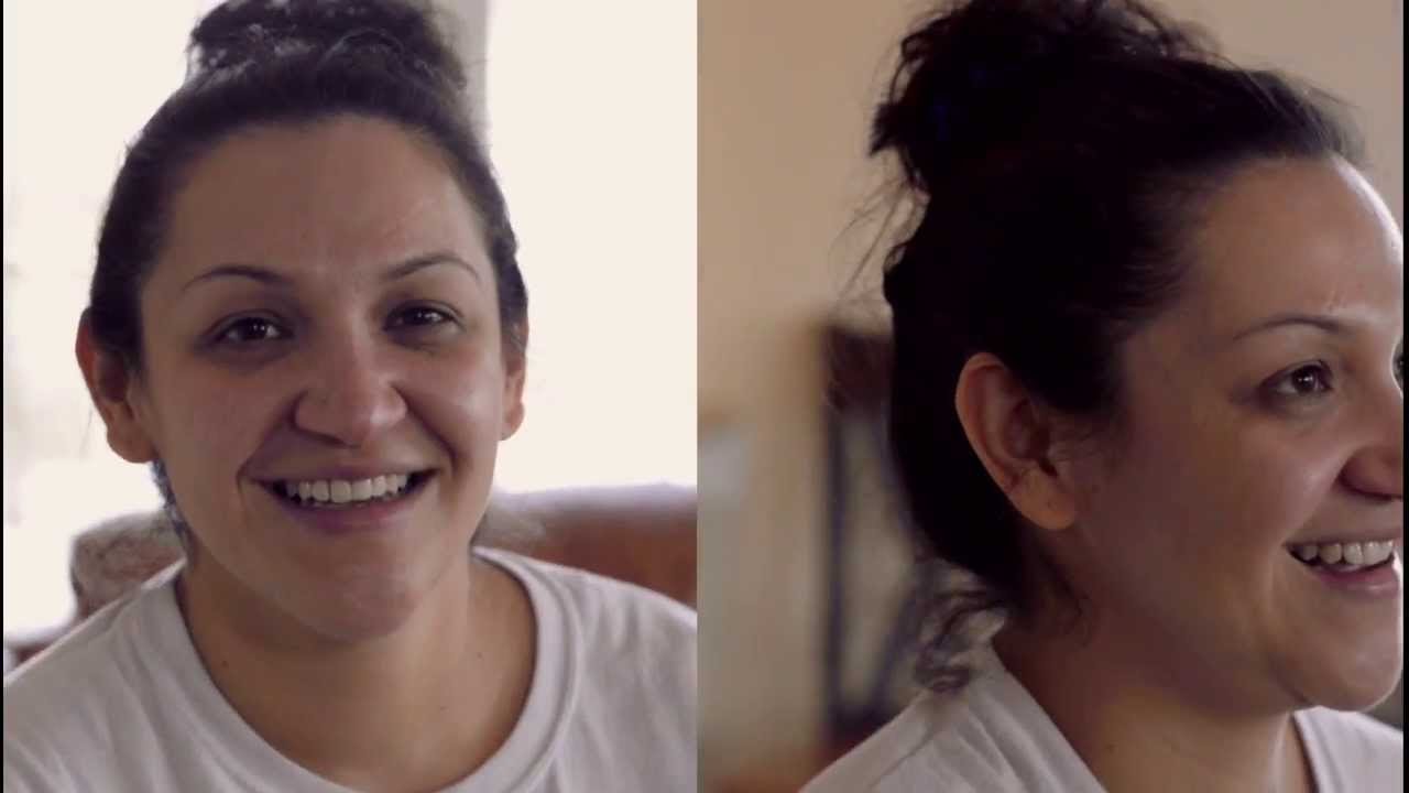 Mommy Makeover using Galaxy 5000 Extensions!
