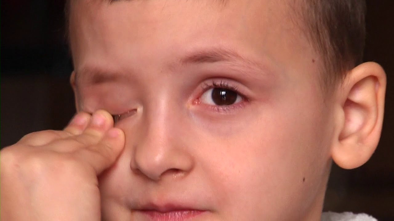 Elegji,  BIR O BIR O FEJZO, SELENICE ARMEN Ma.Përparim Cunaj Kth.Pellat Belaj (OfficialHD)AudA.Dhamo