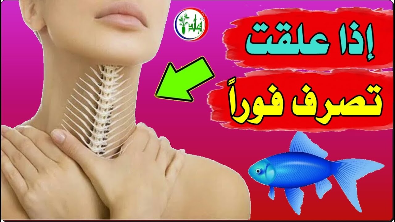 إذا علقت شوكة السمك في الحلق فقم بأحد هذه الأشياء الثمانية على الفور