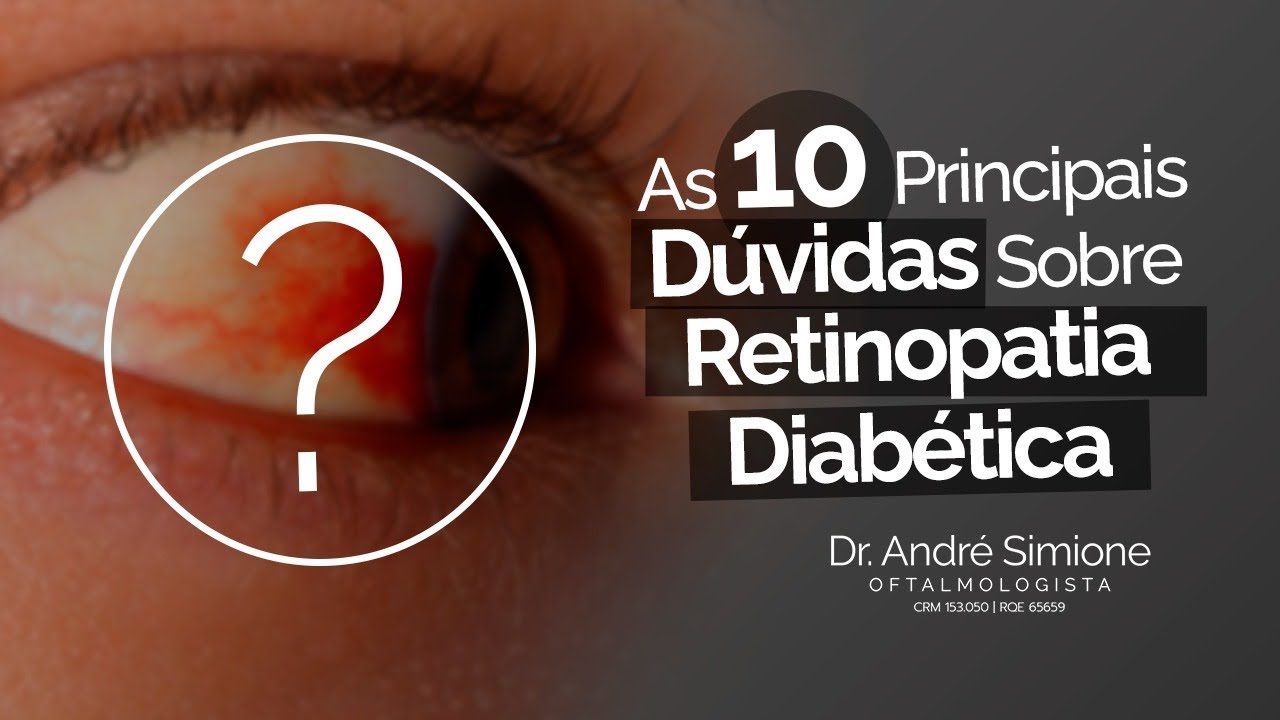 As 10 Principais Dúvidas Sobre Retinopatia Diabética