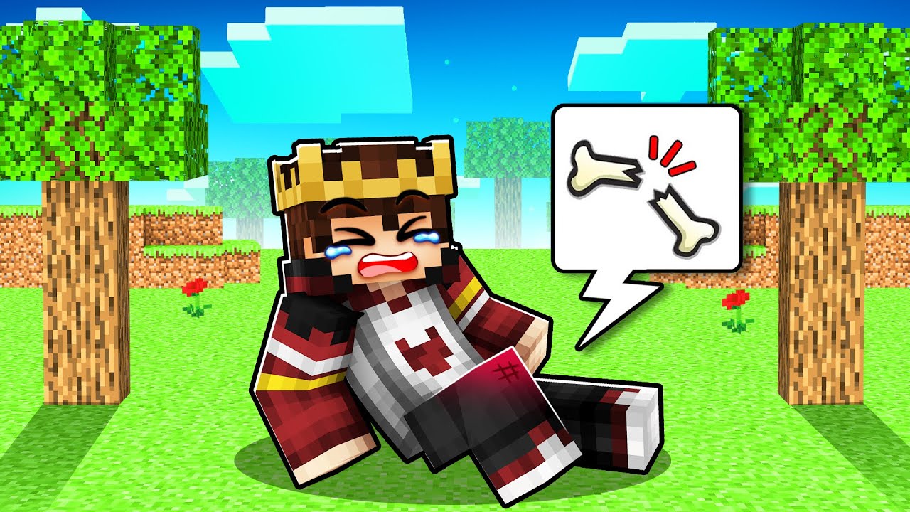 FAKİR BEBEK BACAĞINI KIRDI 😱 - Minecraft