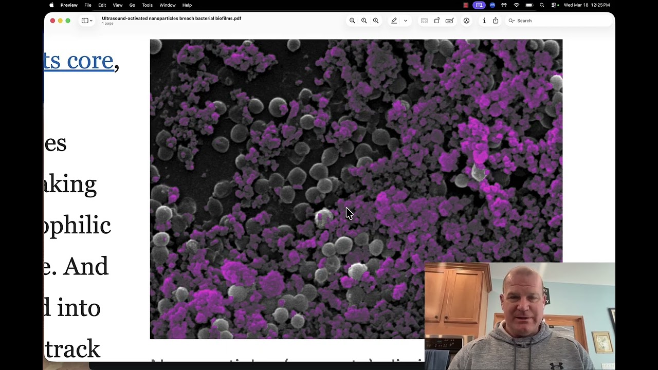 Nanoparticles delivering drugs
