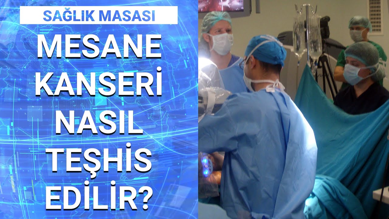 Mesane kanserinin sebepleri nelerdir? | Sağlık Masası - 29 Kasım 2020