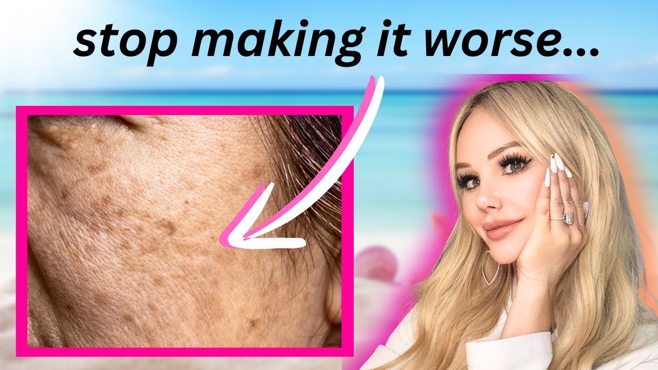 FADE Melasma, Brown Spots, Hyperpigmentation and more (summer skin discoloration guide)