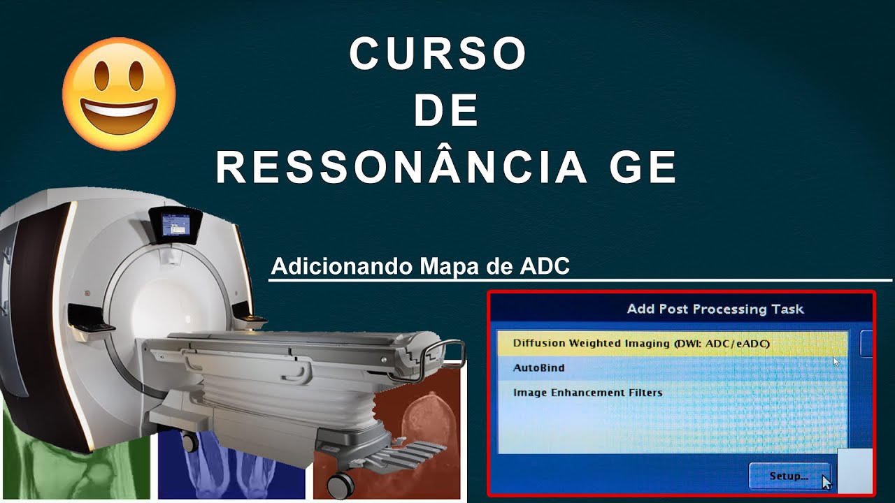 Curso de Ressonância GE