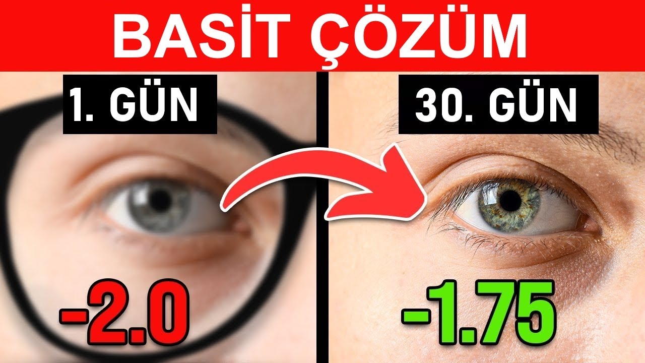 Zayıf Görüşün Ardındaki En Yaygın Eksiklik | Dr. Berg Türkçe