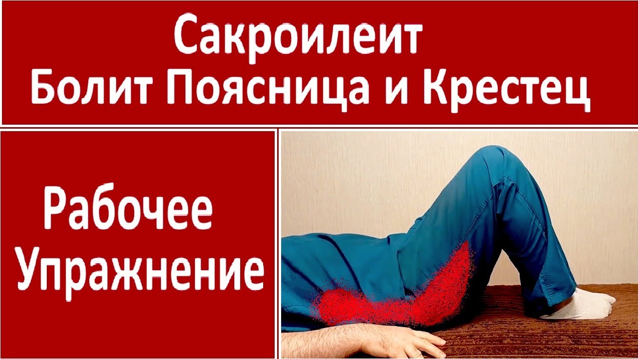 Болит Поясница и Крестец! Сакроилеит! Лечение - Упражнение!