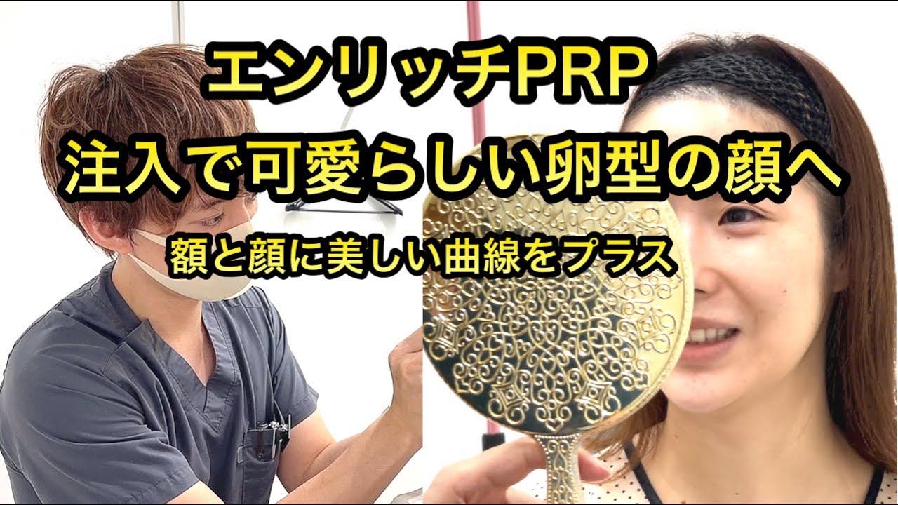 【最先端PRP皮膚再生療法】エンリッチPRP。注入で可愛らしい卵型の顔へ。額と顔に美しい曲線をプラス。