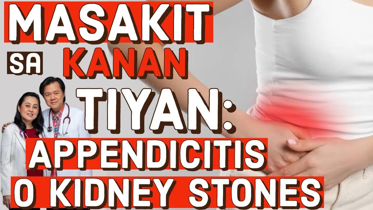 Masakit sa Kanan ng Tiyan: Appendicitis or Kidney Stone? (Repost Video)
