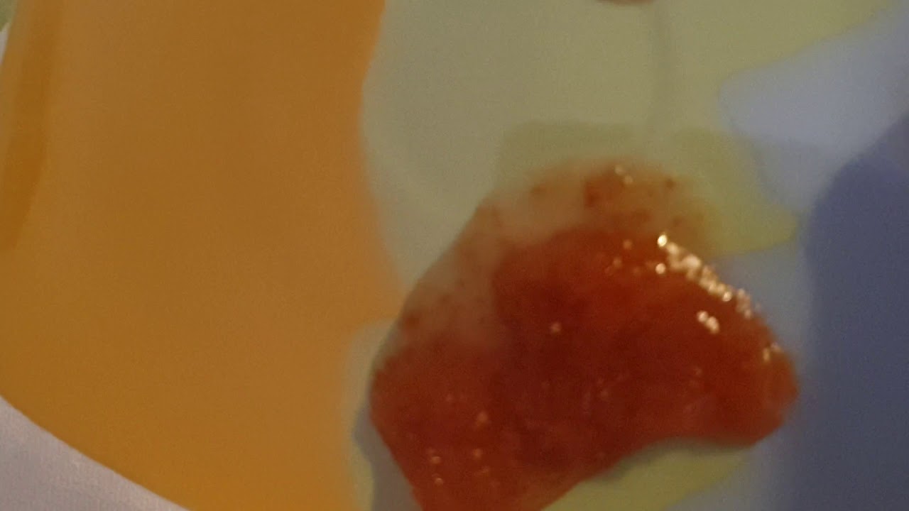 Marmellata di fichi e  noci.