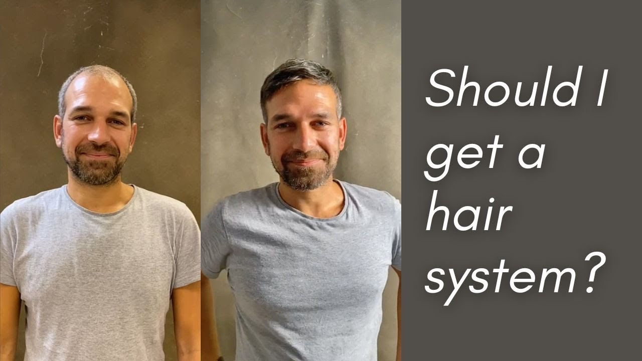 MENS HAIR SYSTEM | Hair piece transformation with Aderans 
