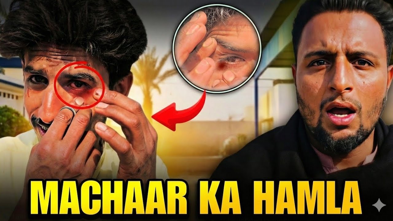 Mosquito Attack! 🦟 Farm Worker Ka Bura Haal 😱🙍 Janwaro ky Sath Masti 🐐 | 2nd Vlog 