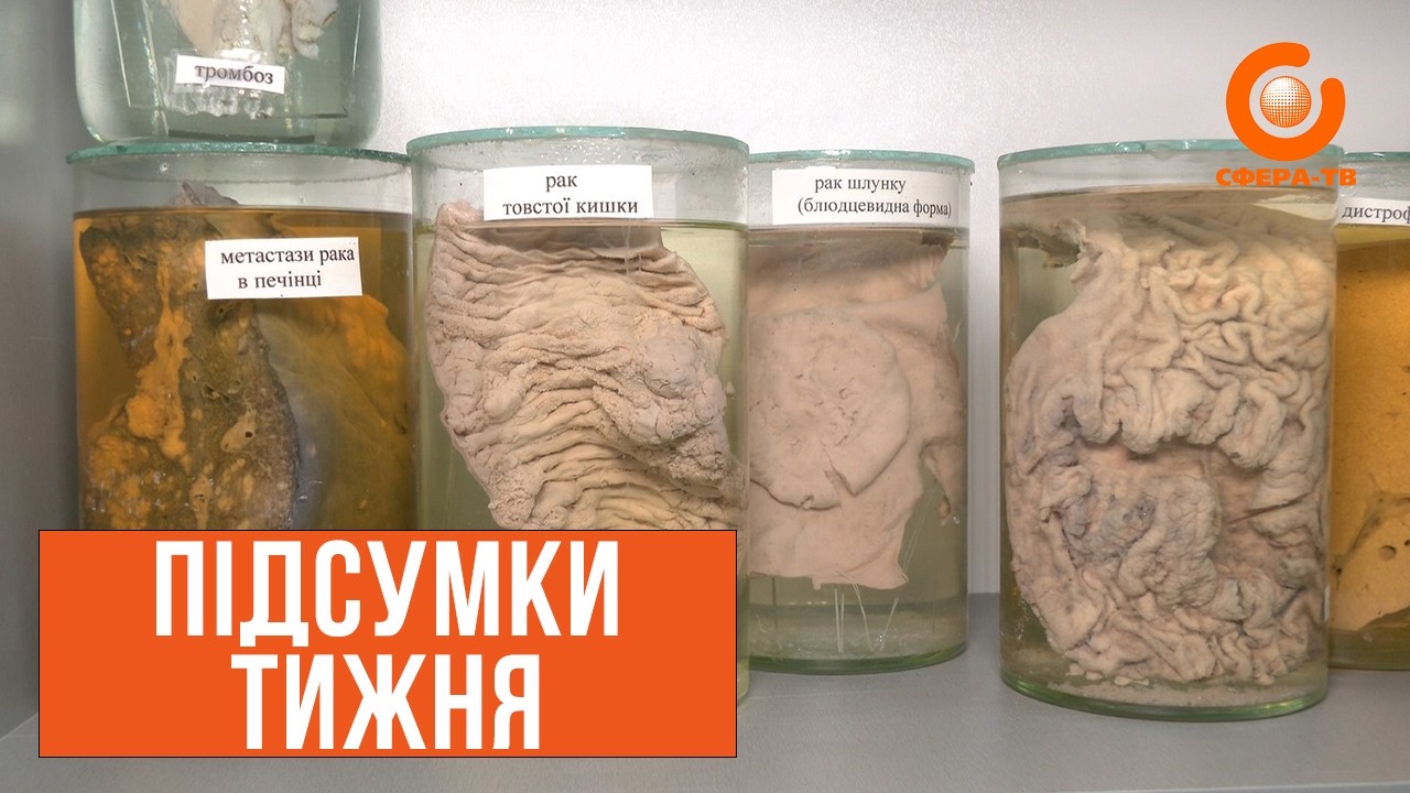 Підсумки тижня