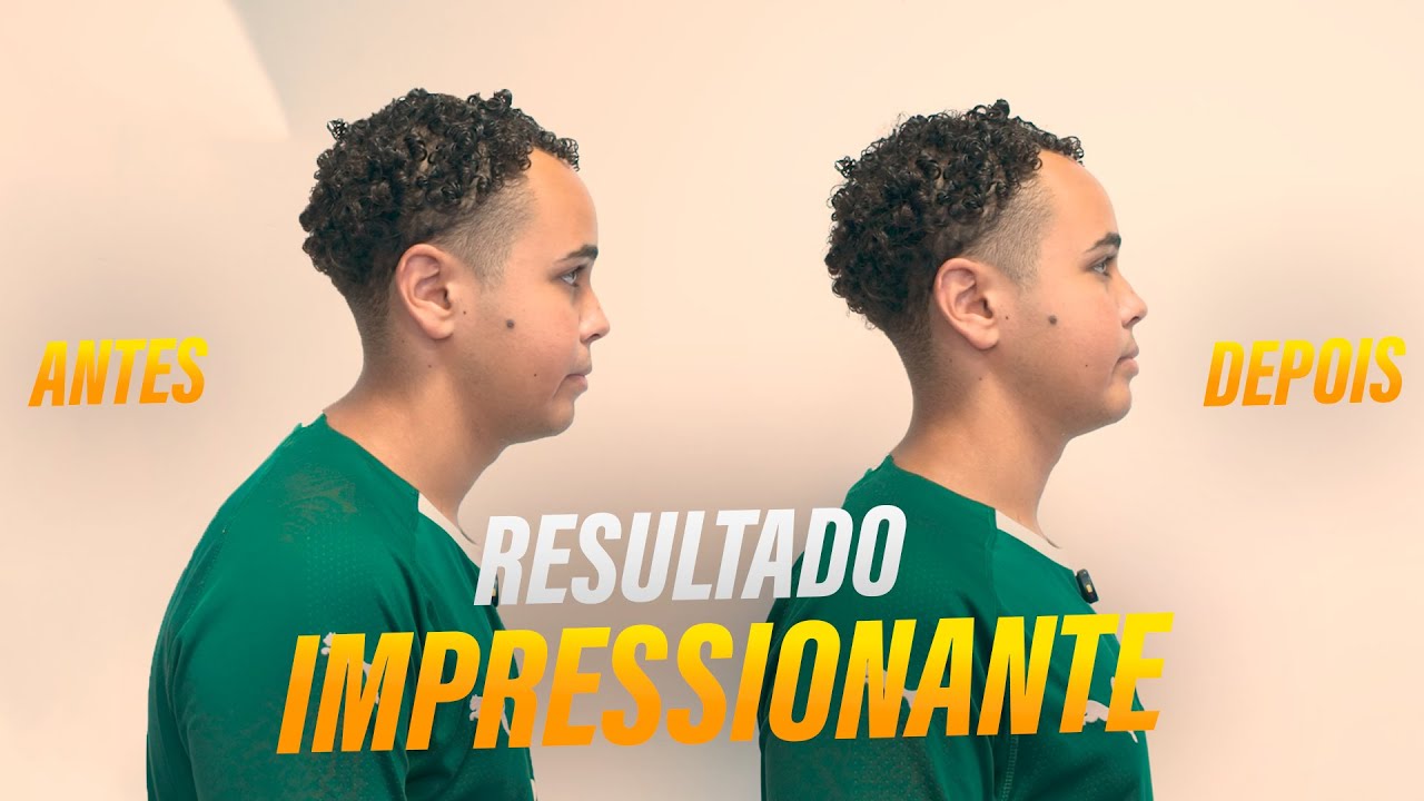 MELHORANDO A POSTURA E ALIVIANDO DORES CERVICAIS | AJUSTE QUIROPRÁTICO