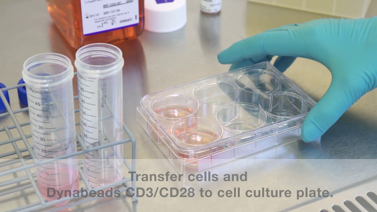 Unique Time-lapse Video of Dynabeads Activating T-Cells