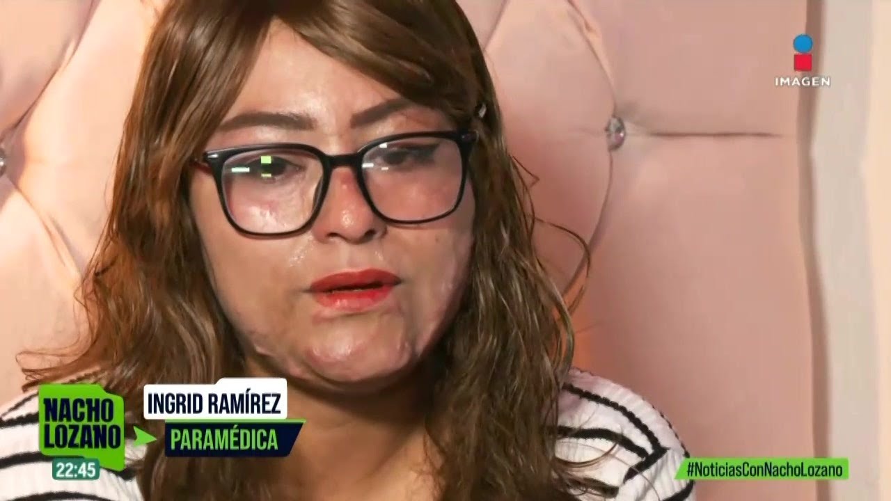 Ingrid, la paramédica que sobrevivió a una explosión en la México-Puebla pide justicia | Nacho L