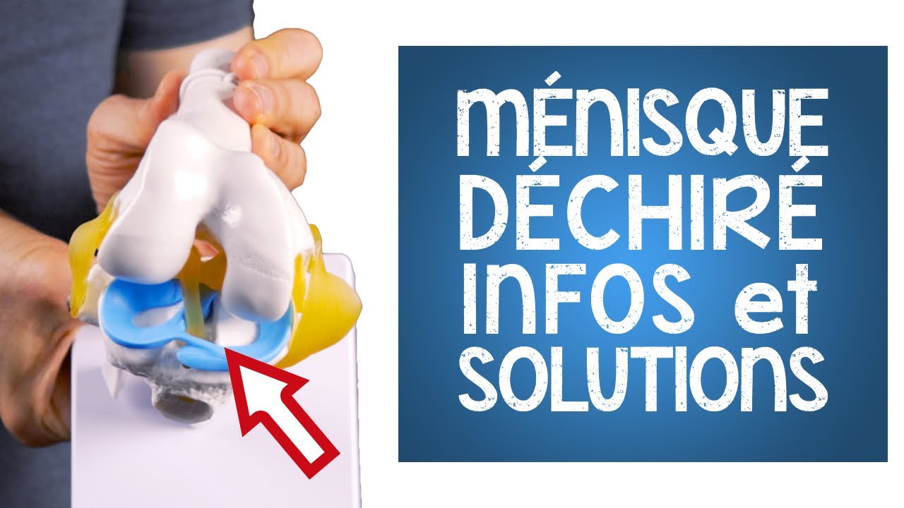 Déchirure de ménisque: vous devriez savoir ceci (infos et exercices)