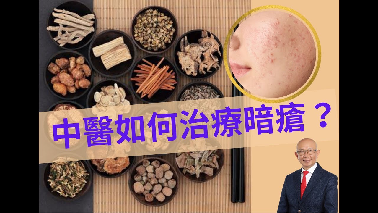 中醫如何治療暗瘡？