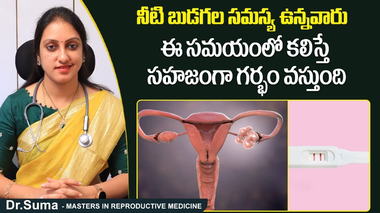 PCOS ఉన్నా సహజ గర్భం రావాలంటే.! | Tips To Get Natural Pregnancy With PCOS | Pregnancy Tips | Ferty9