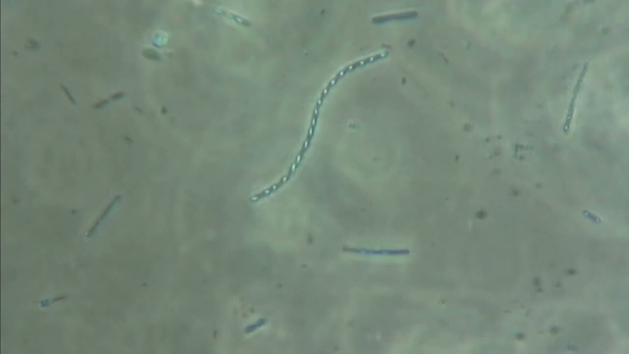 A LOOK AT SPORE FORMING BACTERIA