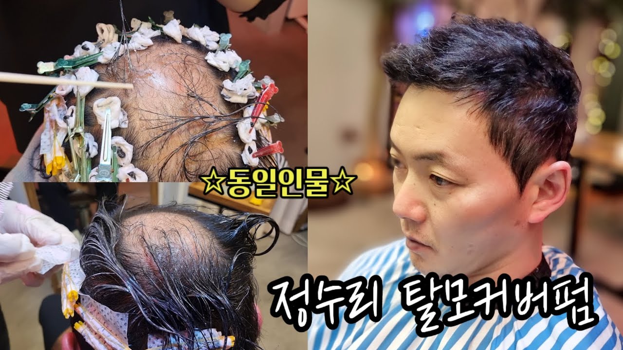 40대 남자 파마 정수리 탈모커버 미용실 숏스핀스왈로펌