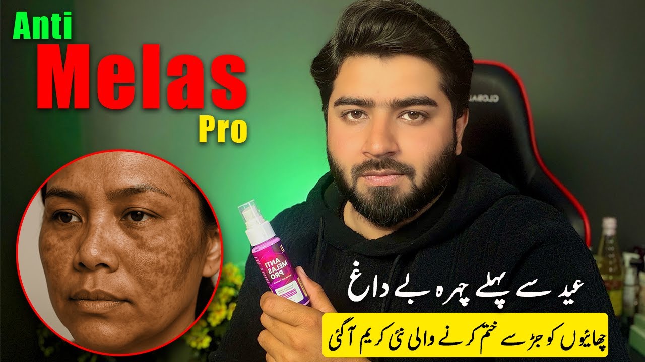 A New Cream For Melasma And Pigmenation - ANTI MELAS PRO