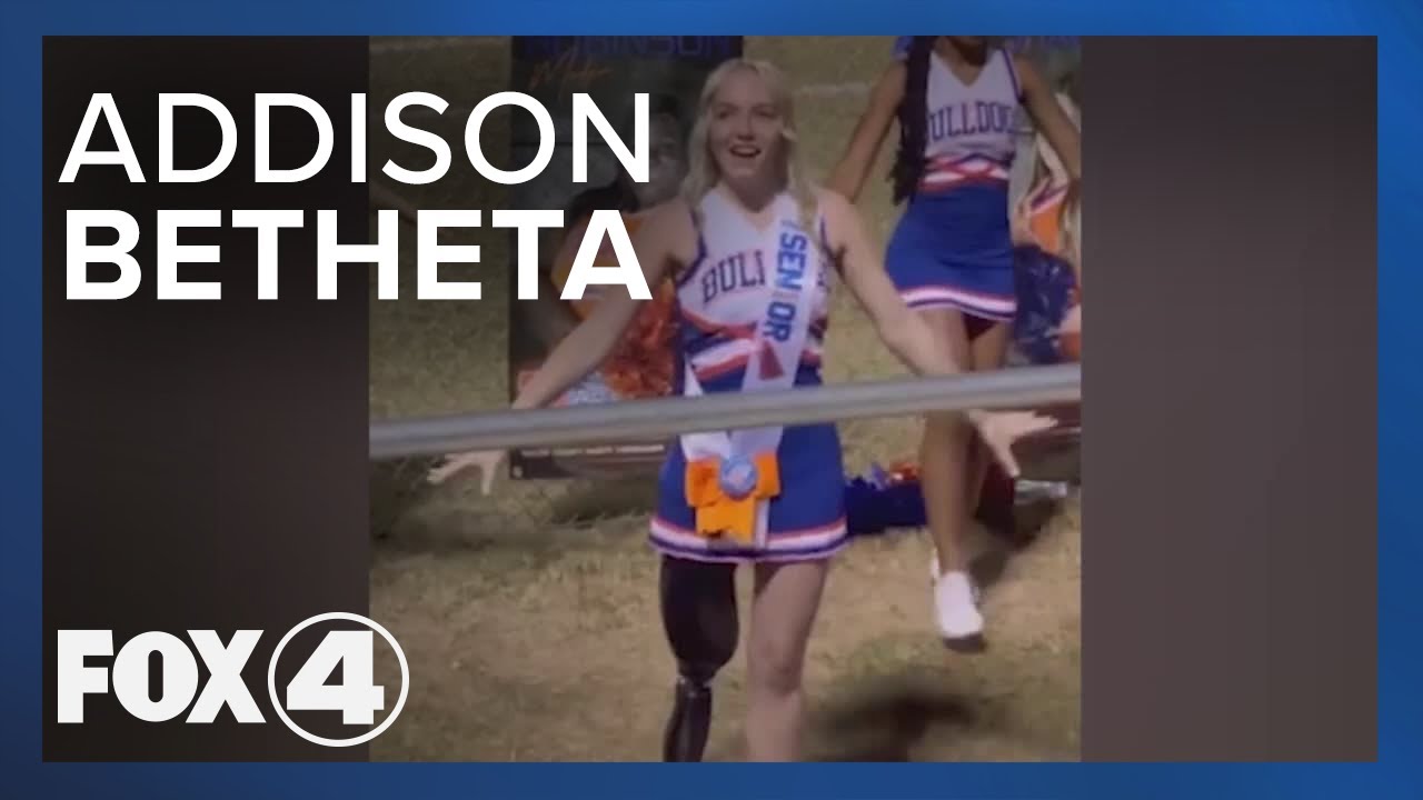 'No Time to be Sad,' Says Teen Who Lost Leg