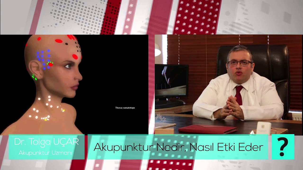 akupunktur nedir  nasıl etki eder