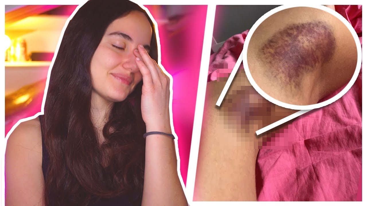 HO RISCHIATO DI M0RIRE | Totta