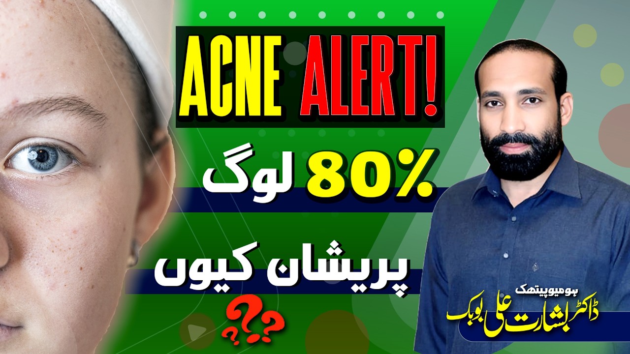 ACNE ALERT! Why 80% of People Are Struggling With Acne | Dr Basharat Ali Bubak | Heal Fast