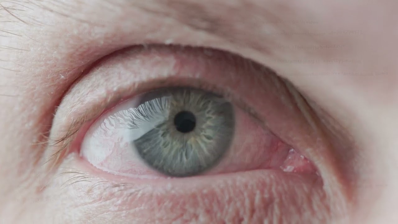 gray eye of middle-age caucasian male, brightly lit closeup