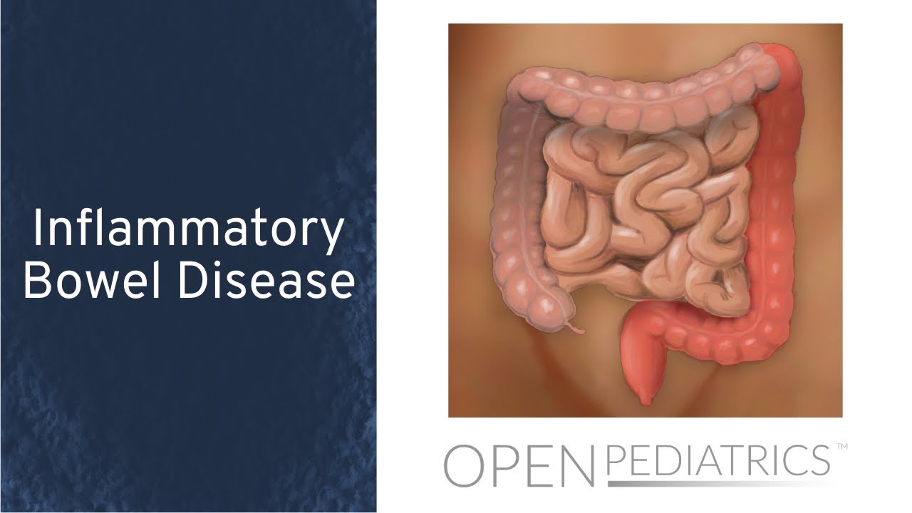 Inflammatory Bowel Disease by J. Ouahed, L. Collen | OPENPediatrics